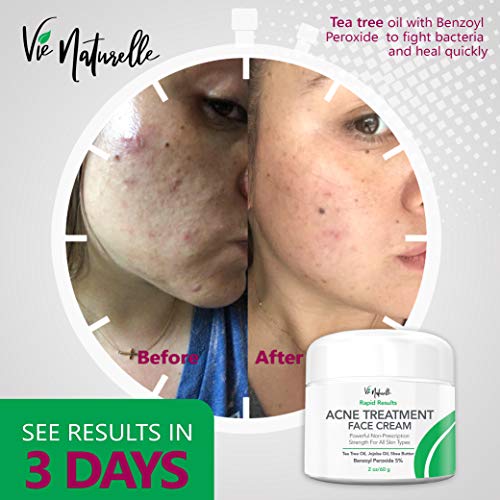 benzoyl peroxide on cyst