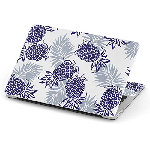 igsticker MacBook Air 13inch 2018 2019 2020 ���f�� / A1932 ��p�X�L���V�[�� �}�b�N�u�b�N �G�A Mac 13" �C���` Retina ��p�V�[�� �t�B���� �X�e�b�J�[ �A�N�Z�T���[ �ی� (2010�N 