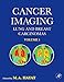 Cancer Imaging: Lung and Breast Carcinomas