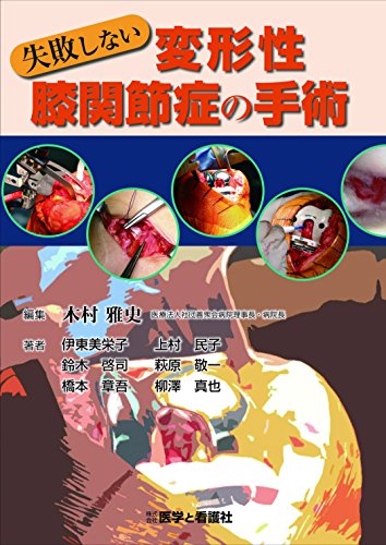 スマホ 無料電子書籍 失敗しない変形性膝関節症の手術 バイ