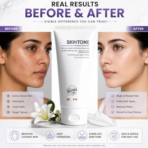 Image of SkinTone Enhancing Cream with Kojic Acid, Hyaluronic Acid & Alpha Arbutin | Daily Face & Body Moisturizing Cream | Lightweight Formula | Dermatologist Tested | For All Skin Types | 50g