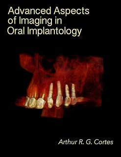 Advanced Aspects of Imaging in Oral Implantology