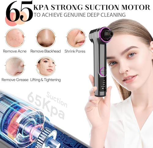 Image of Docoss Ultrasonic Black head Remover Tool with Heating Mode -Rechargeable White heads & Blackhead Removal Machine for Nose with 5 Suction Levels and Probes, 2 in 1 Pore Cleaner for Brighter Face