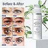 Rapid Anti-Aging Serum - Rapid Anti Wrinkle Serum, Advanced Formula, Professional facial serum for Eye Bags, Dark Circles, Wrinkles, Crows Feet, fine lines (30 mL)