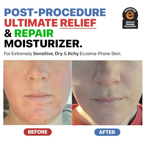 Dr. Arsy Eczema Cream for Adults & Kids – Hypoallergenic Barrier Repair Moisturizer, Clinically Proven (3 Studies), Fragrance-Free, Dermatologist Tested, Face & Body Hydration, NEA Accepted, USA Made