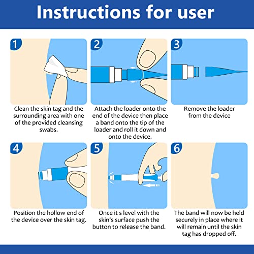 Warzen Entfernungs-Set, Auto Tool Kit Skin Tag Remover, Schmerzfrei Automatisches Stiftset Hautmarken Entferner… – Ansicht 5