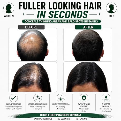 Image of THICK FIBER Fibers for Thinning Hair & Bald Spots - Conceals Hair Loss in Seconds - Volume Powder for Women & Men (Black, 56 g (Pack of 1))