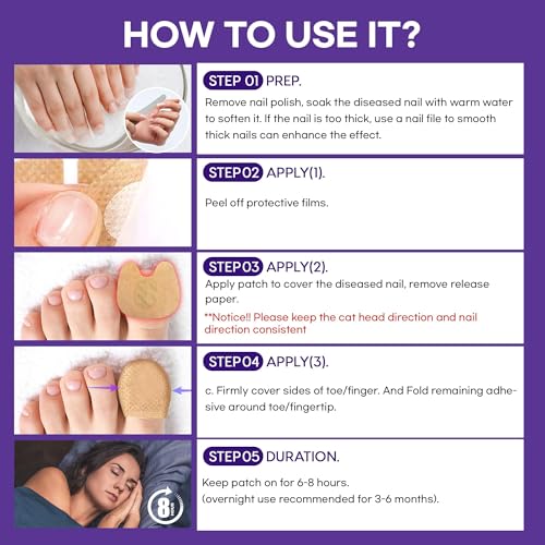 image for PURESKIN Extra Strength Toenail Fungus Treatment Patches: Nail Fungus 