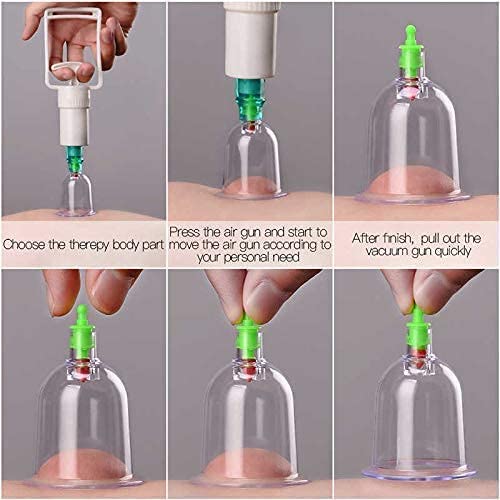 DOSJNI 12pcs Bio Magnetic Cupping Therapy Set - Image 8