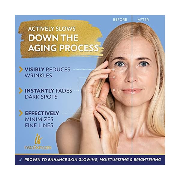 Niacinamide-Serum-for-Face-10-with-Zinc-1-Vitamin-B3-Facial-Serum-for-Acne-Treatment-Dark-Spot-Remover-2-oz-InstaSkincare DOUBLE SIZED (2Oz) Niacinamide Serum for Face 10% with Zinc 1% Vitamin B3 Brightening Serum for for Acne, Dark Spots, Tone, Texture and Hydrating