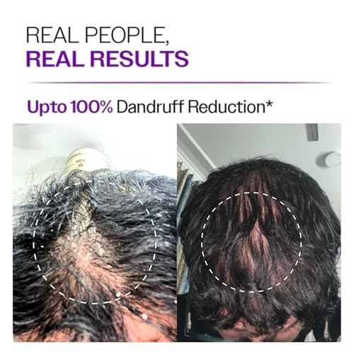 Image of Rosemary Anti Dandruff Shampoo