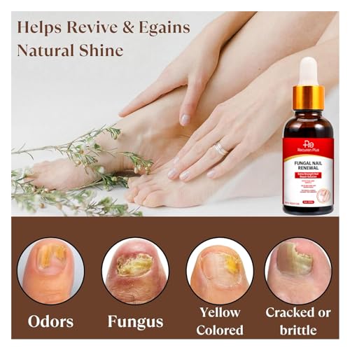 Nail Fungus Treatment for Toenails: Toenail Fungus Treatment Extra Strength - Nail Fungus Treatment - Nail Repair - 30 ML - Image 4
