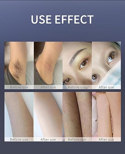 755/808/1064nm Soprano Ice Titanium Painless Diode Hair Removal Machine beauty salons, or personal home care. - Image 9