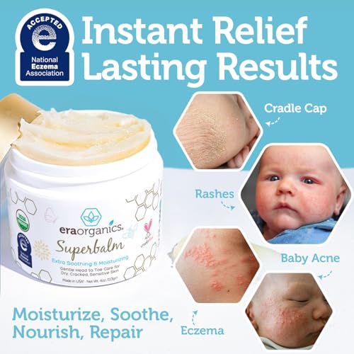 Image of Era Organics Healing Ointment for Babies - USDA Certified Organic Natural Moisturizer Gentle on Sensitive Skin Prone To Baby Eczema, Cradle Cap (Infant Seborrheic Dermatitis), Rashes, Hives - 4oz