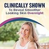 Gold Bond Age Renew Retinol Overnight Body & Face Lotion, With Retinol & Peptide Complex, 13 oz. - Image 3