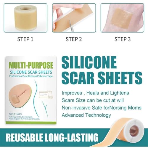 Image of VELOMIX Multipurpose Silicone Scar Sheets, Silicon gel sheets for Scars,Silicone Gel Tape for Scar Removal, Professional Scar Removal Sheets for C-Section, Surgery, Burn Protein (pack of 1)