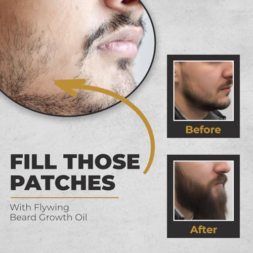 Image of Flywing Beard Growth Oil, 100% Natural Ingredients, 30ml, For Beard Growth