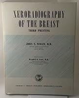 Xeroradiography of the Breast 0398024405 Book Cover