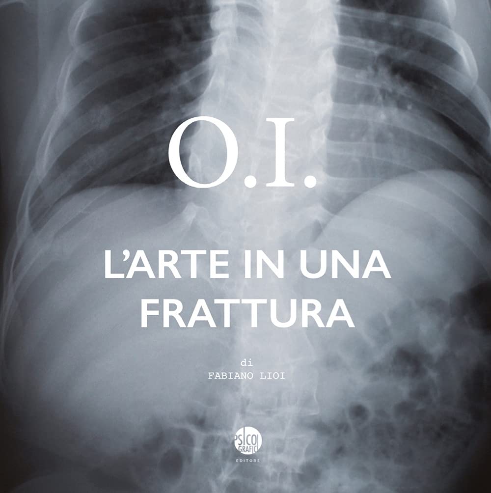 O.I. L'arte in una frattura le récit touchant sur les os de cristal