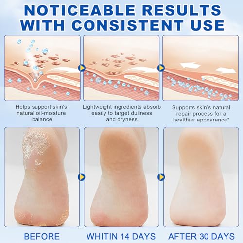 60% Urea & 2% Salicylic Acid Foot Cream: Intensive Cracked Heel Repair & Deep Moisturizing for Severely Dry Skin. Repairing Cream for Feet, Heels, Hands, Knees & Elbows - Image 5