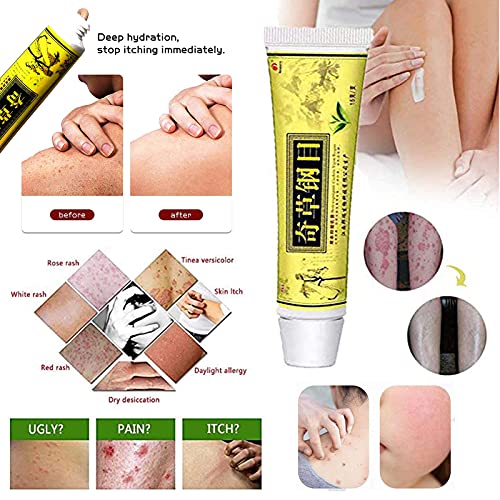 Natural Chinese Herbal Cream, Eczema Cream, Anti-Itch Cream, Dedicated for Dermatitis and Eczema Pruritus Psoriasis… - Afbeelding 4