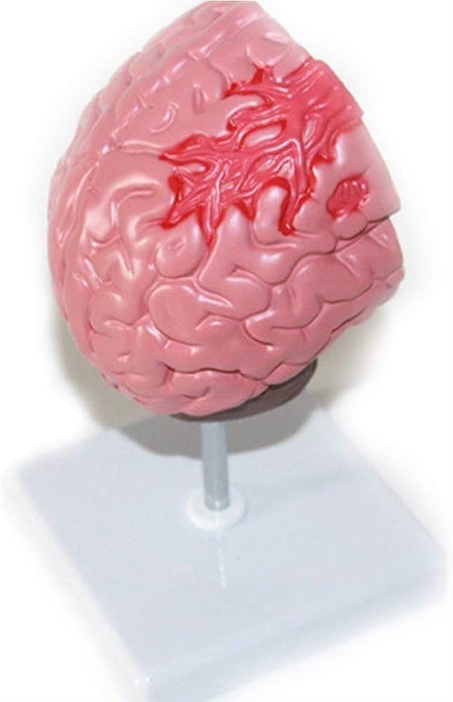 Tryb Nauczania Anatomii, Tryb Montażu Chorób Mózgu Ludzkiego, Tryb Anatomii Neurochirurgii, Tryb Nauczania Patologii Krwotoków Mózgowych