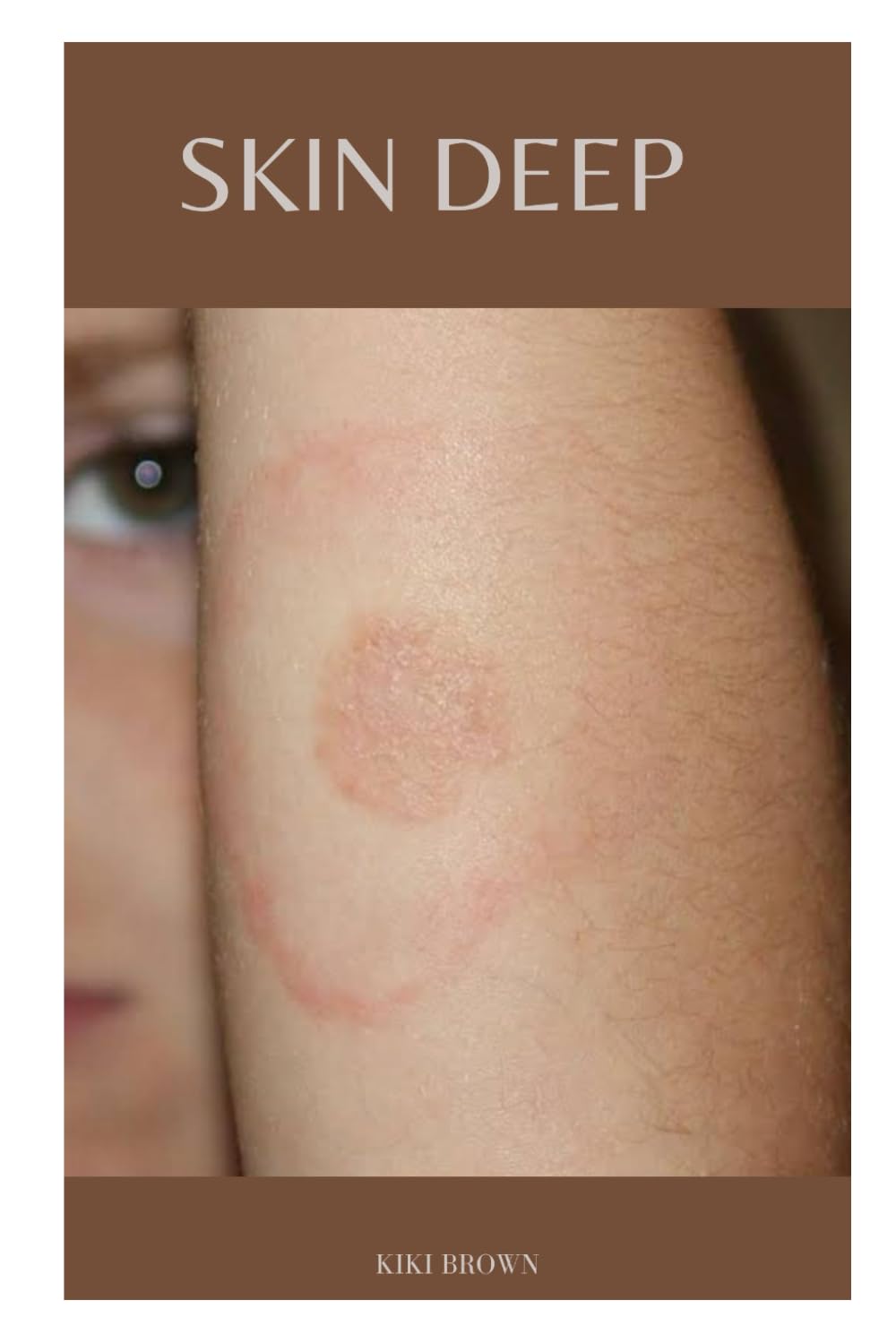 SKIN DEEP