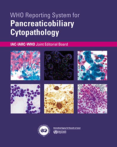 WHO reporting system for Pancreaticobiliary Cytopathology: 4