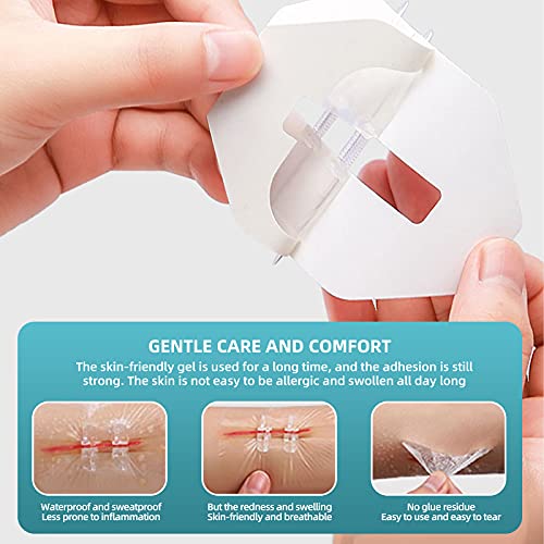 Emergency Laceration Wound Closures， Emergency Bandage Without Stitches Reduce Scar Area， Repair Wounds Strips， Camping Gear（2.4 X 2.8Inch）2 Pieces #TOP1