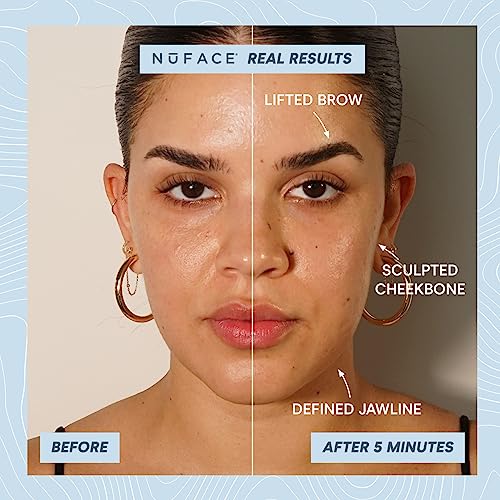 Nuface Trinity+ Starter Kit – Microcurrent Facial Toning Device With Aqua Gel Activator 1.69 Fl Oz, Silk Crème Activator 0.5 Fl Oz And Applicator Brush #TOP1