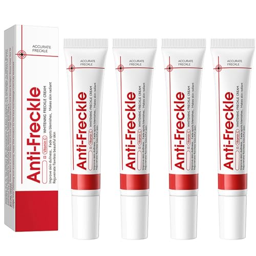 Crema blanqueadora para eliminar manchas de pigmento facial, crema blanqueadora contra manchas oscuras en cremas para eliminar manchas pigmentadas faciales, crema blanqueadora para pecas (4 unidades)