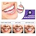 Purple Teeth Whitening Treatment with Natural Ingredients, Color-Correcting Formula to Neutralize Yellow Tones & Brighten Smile, 1 fl oz