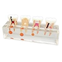Vista 2 de Modelo de tratamiento endodóntico de 4 etapas para estudiar los dientes de enseñanza Modelo #4003