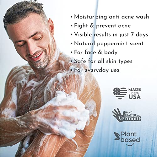 Truly Clear One-Step Solution Acne Bar, Alcohol Free Face And Body Cleanser, Non-Drying Acne Treatment For Face, Chest, Butt And Back Acne, Body Acne Face Wash With Hyaluronic Acid #TOP4