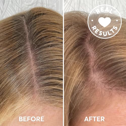 Image of Madison Reed Root Perfection Root Touch Up Kit for T-Zone - 8N Bergamo Dark Blonde, 2 Permanent Applications, 100% Gray Coverage in 10 Min | PPD-Free & Ammonia-Free, Includes Hydrating Hair Mask