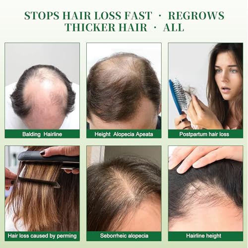 Image of Batana Oil Shampoo, Hair Growth Shampoo for Thinning Hair & Hair Loss Treatment - Organic Rosemary, Formula with Biotin & Keratin to Reduce Shedding, Thicken Hair For Men & Women10.1oz