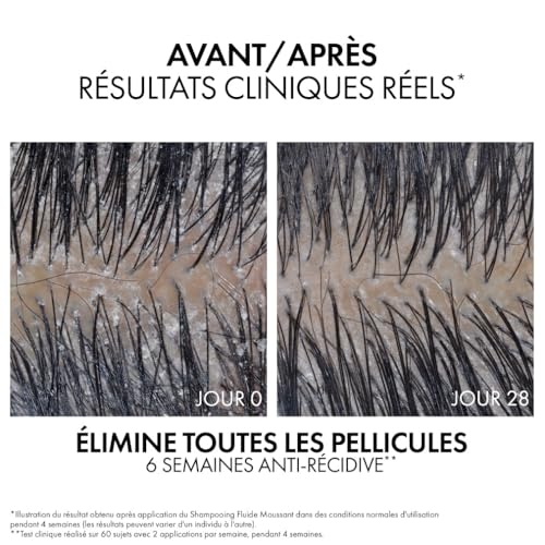 Vichy, Dercos Technique, Shampooing Fluide Moussant, Soin Traitant Antipelliculaire, Anti-Pellicules & Anti-Démangeaisons, Cheveux Bouclés et Crépus, 200 ml