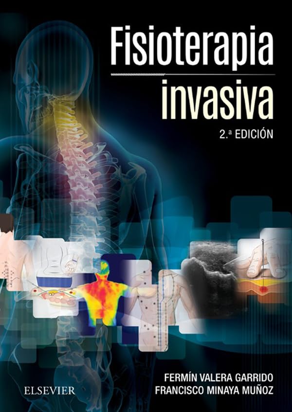 Fisioterapia invasiva (Spanish Edition)