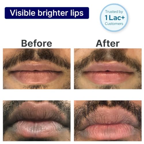 Image of ALANNA Lip Wash for Men | Advanced Foaming Lip Scrub & Exfoliator for Dry, Dark & Lip Pigmentation | Remove Chapped Lips & Sun Tan | 1% PHA & .5% Ferulic Acid - Brightening Lip Care for Smokers, 20ml