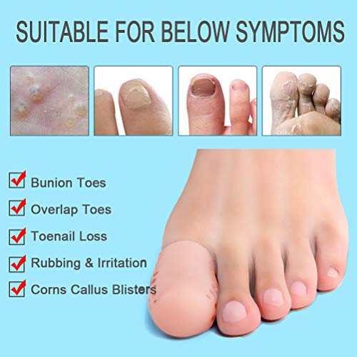 Beschermers voor grote teen, 10 stuks, ademend, siliconen, teenbeschermers, biedt pijnverlichting van likdoorns… - Image 5