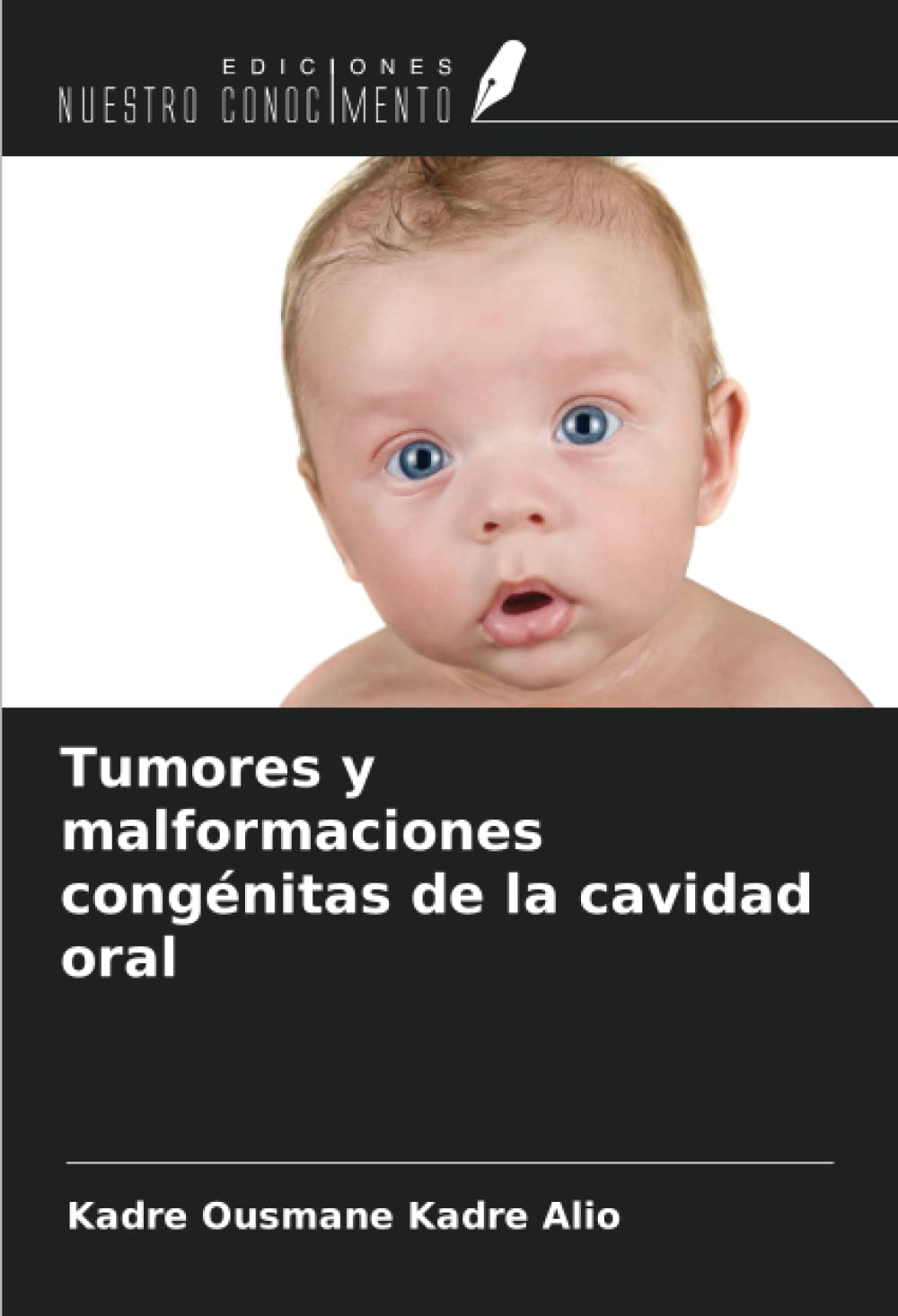 Tumores y malformaciones congénitas de la cavidad oral