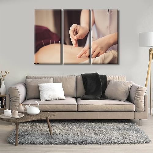 Image of TUMOVO Physical Therapists do Acupuncture Canvas Wall Art Traditional Chinese Medicine Canvas Photo 3 Panels Prints for Wall Decor Giclee Print Gallery Packaging Artwork Ready to Hang (42 inch Wx28 H)