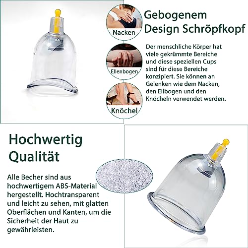 24 Stück Schröpfgläser mit Vakuumpumpe,Schröpfsets für Entspannen Muskeln – Ansicht 5