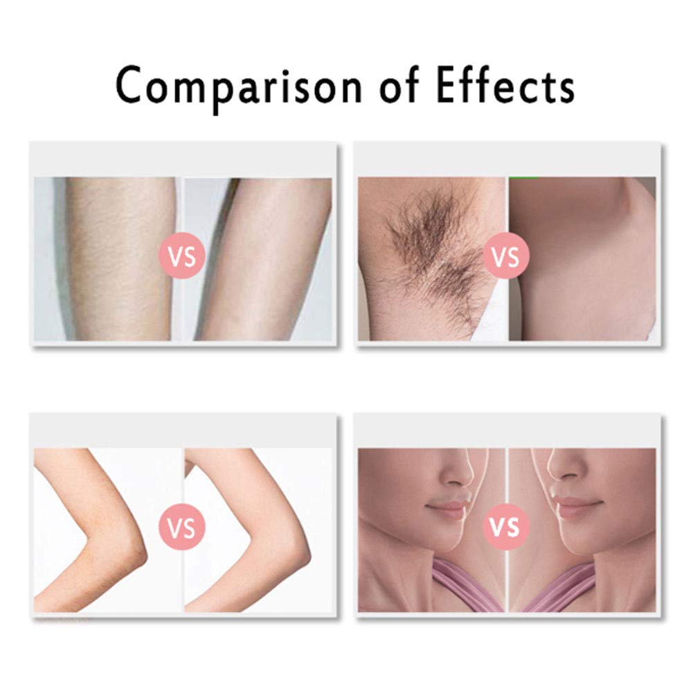 ELQ Appareil D'épilation IPL pour Femmes, Épilateur De Cheveux Indolore et Sûr pour Le Corps, Le Visage, Les Aisselles Et Ligne De Bikini