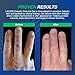 LAVIOR Diabetic First-Aid Gel 1oz – Speeds Healing for Cuts, Scrapes, Burns & Minor Injuries, Physician Recommended, Clinically Proven, Hypoallergenic, Infection Prevention & Pain Relief