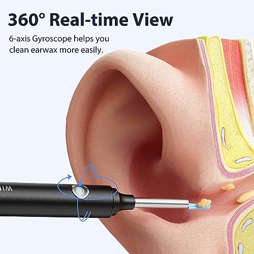 Image of Ear Wax Removal Tool Camera, 1080P Ear Cleaner with Anti-Dust Cover, Wifi Ear Camera Otoscope with Ear Pick Set for iPhone, iPad & Android Smart Phones