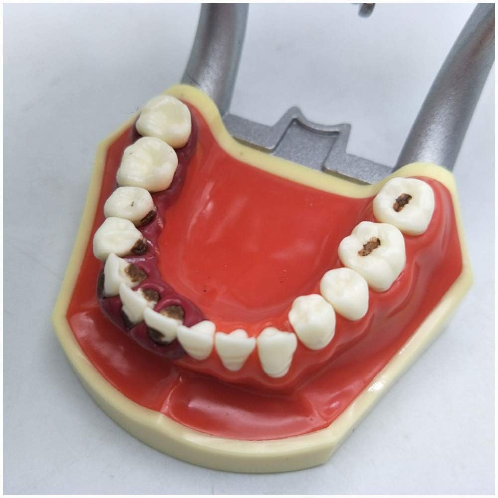 Model przyzębia zębów dentystycznych zęby jamy ustnej dziąsła ząb Typodont Implant Model do nauczania Standard badania