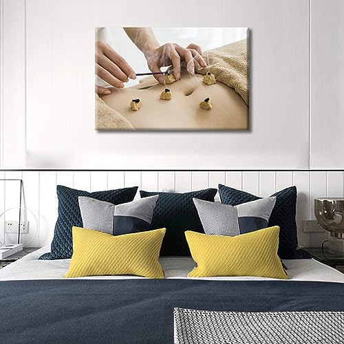 Image of Posters & Prints 1 Panels Nosocomium Paintings Wall Art Moxibustion Art Prints Framed Wall Art Nosocomium Giclee Wooden Framed Gallery-Wrapped Ready to Hang (16 inch Wx24 H)
