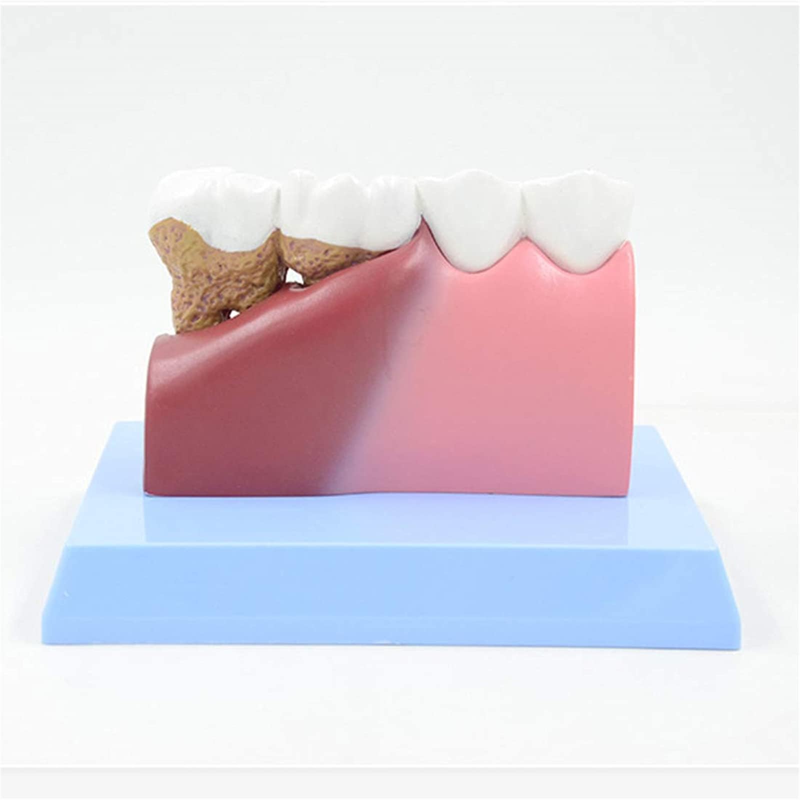 Model zębów dentystycznych, model anatomii zębów ludzkich, z instrukcjami, demonstracja patologii, model dentystyczny, do gabinetu dentystycznego, narzędzie edukacyjne