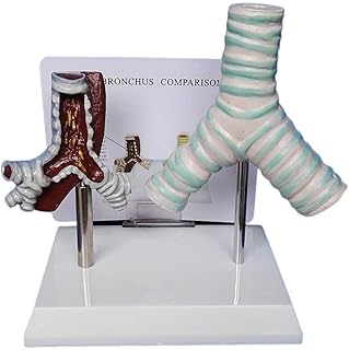 Human Organ Anatomical Model - Human Smoking Trachea and Normal Trachea Comparison Model - for Medical Educational Training Aid Organ Anatomical Model,Teaching Study Tool